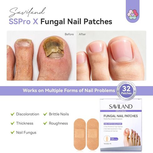 SAVILAND Extra Strength Fungal Nail Patches FSA-HSA: 8H Overnight Repair 1% Tolnaftate Toenail Treatment 32 P Nighttime Nail Renewal Restores Damaged Nails Discolored Thick Yellow Healthy Appearance in Kuwait