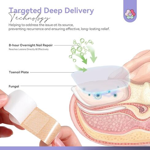 SAVILAND Extra Strength Fungal Nail Patches FSA-HSA: 8H Overnight Repair 1% Tolnaftate Toenail Treatment 32 P Nighttime Nail Renewal Restores Damaged Nails Discolored Thick Yellow Healthy Appearance in Kuwait