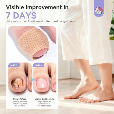 SAVILAND Extra Strength Fungal Nail Patches FSA-HSA: 8H Overnight Repair 1% Tolnaftate Toenail Treatment 32 P Nighttime Nail Renewal Restores Damaged Nails Discolored Thick Yellow Healthy Appearance in Kuwait