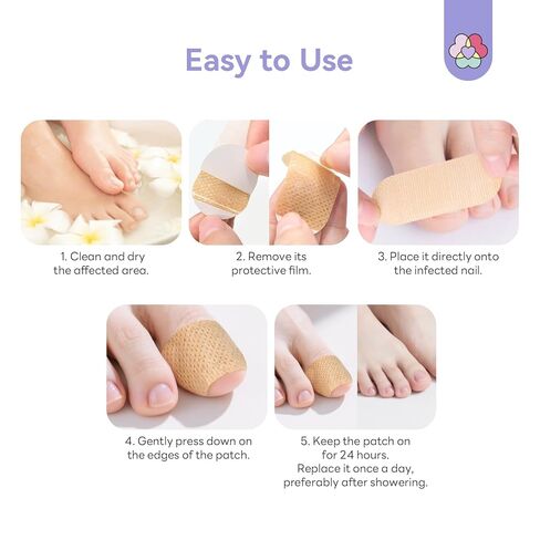 SAVILAND Extra Strength Fungal Nail Patches FSA-HSA: 8H Overnight Repair 1% Tolnaftate Toenail Treatment 32 P Nighttime Nail Renewal Restores Damaged Nails Discolored Thick Yellow Healthy Appearance in Kuwait