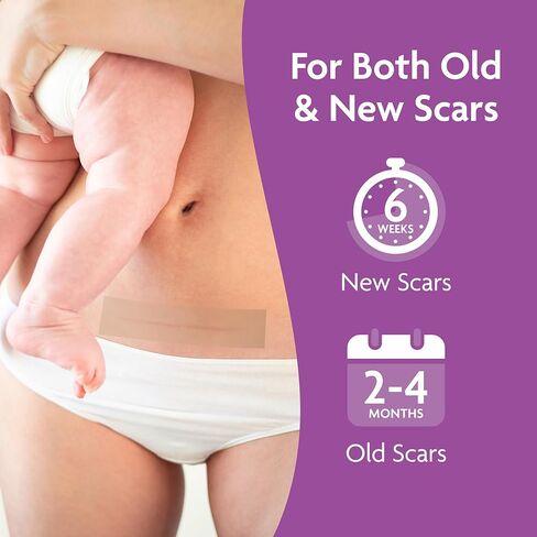 أوراق ندبات السيليكون تريلاستين للقسم القيصري - شرائط ندبات سيليكون طويلة جدًا من الدرجة الطبية للندبات الجراحية والجُدرات - أوراق ندبات سيليكون مقاومة للماء قابلة لإعادة الاستخدام (4 قطع) in Kuwait