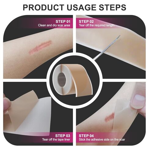 صفائح ندبة من السيليكون، شريط ندبات من السيليكون الطبي للندبات الجراحية، شريط سيليكون بعرض 1.77 بوصة × 120 بوصة، شريط سيليكون أوسع 3 أمتار لندبات الجدرة، الضخامية، القسم القيصري، شد البطن، بقع الجراحة وندبات الحروق in Kuwait