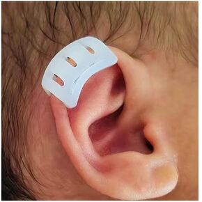 Infant Lop Ear Deformity Correction Clip For Newborn Baby, Fixing Auricle Valgus Patch Stickers Children Ear Shape Aesthetic Corrector Without Surgery in Saudi Arabia