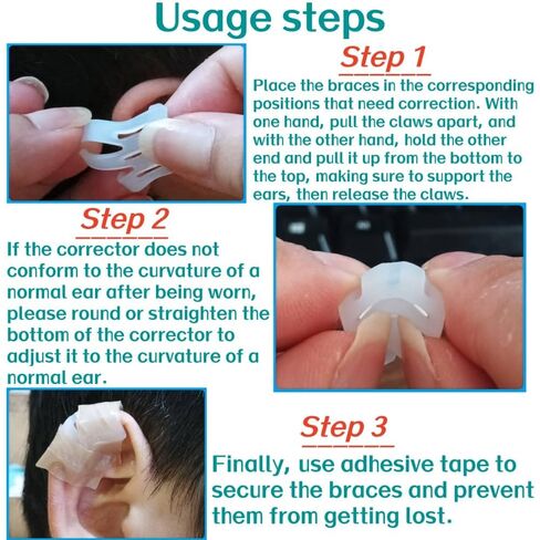 Infant Lop Ear Deformity Correction Clip For Newborn Baby, Fixing Auricle Valgus Patch Stickers Children Ear Shape Aesthetic Corrector Without Surgery in Saudi Arabia