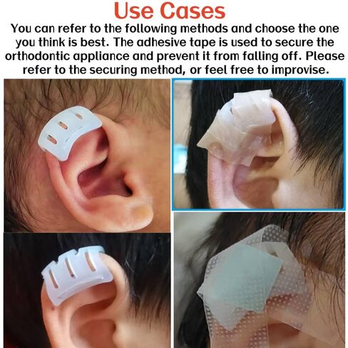 Infant Lop Ear Deformity Correction Clip For Newborn Baby, Fixing Auricle Valgus Patch Stickers Children Ear Shape Aesthetic Corrector Without Surgery in Saudi Arabia
