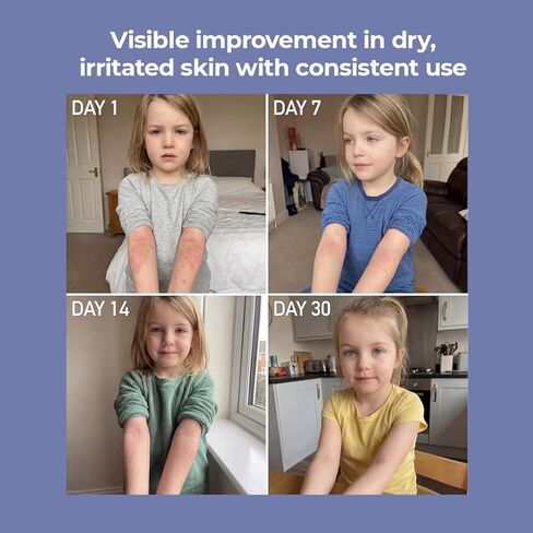 جزيرة سفين ميراكل مانوكا - بلسم طبيعي للبشرة (3.5 أونصة) | كريم الأكزيما الخالي من الستيرويد والبلسم المعجزة | معتمد من أطباء الجلدية | بزيت أوراق المانوكا | للبشرة الجافة والحساسة | صنع في نيوزيلندا in Kuwait