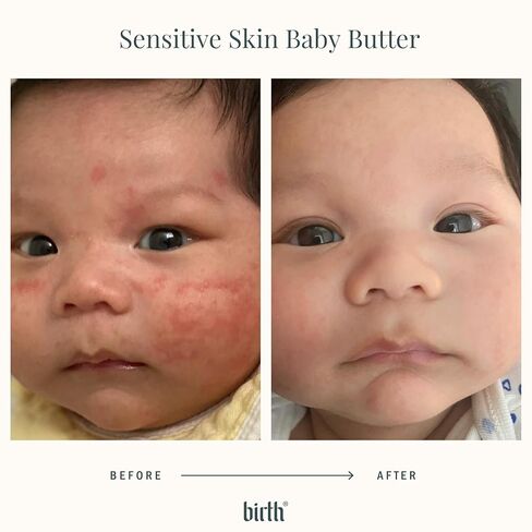 Birth's Baby Eczema Butter | Steroid-Free | Natural Cocoa Seed Butter with Colloidal Oatmeal | Itchy & Irritated Skin | Non-Greasy Formula to Soothe Rashes & Dryness | Sensitive Skin | 4oz 113 ml in Kuwait