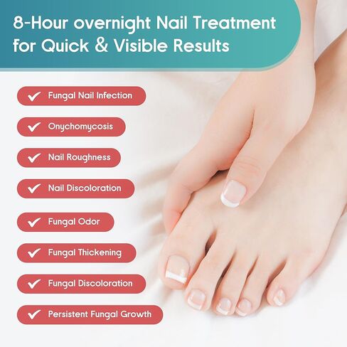 Fungal Nail Patches, Toenail Fungus Treatment Extra Strength - 20 Fungal Nail Patches for Toe Nail Fungus Treatments, 8-Hour Nighttime Nail Fungus Patches for Nail Fungus Treatment in Kuwait