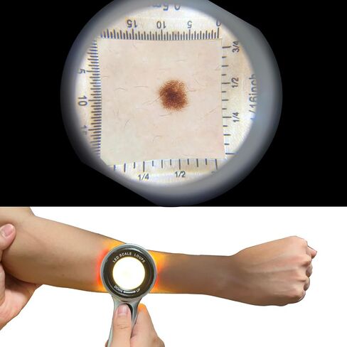 منظار الجلد المستقطب للجيب – محلل الجلد المحمول القابل لإعادة الشحن مع تلألؤ، تكبير 10× in Kuwait