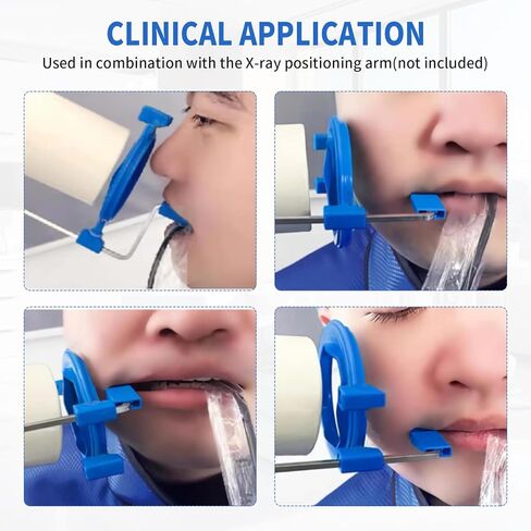 PER4MANCE Dental X-Ray Aiming Rings, Each Pack of 5, Red & Blue, Fully Autoclavable in Kuwait