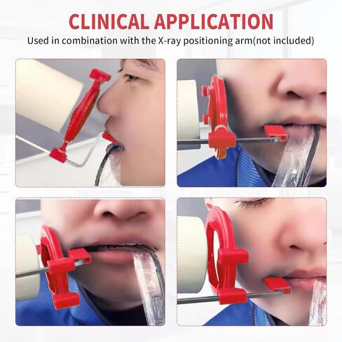 PER4MANCE Dental X-Ray Aiming Rings, Each Pack of 5, Red & Yellow, Fully Autoclavable in Kuwait