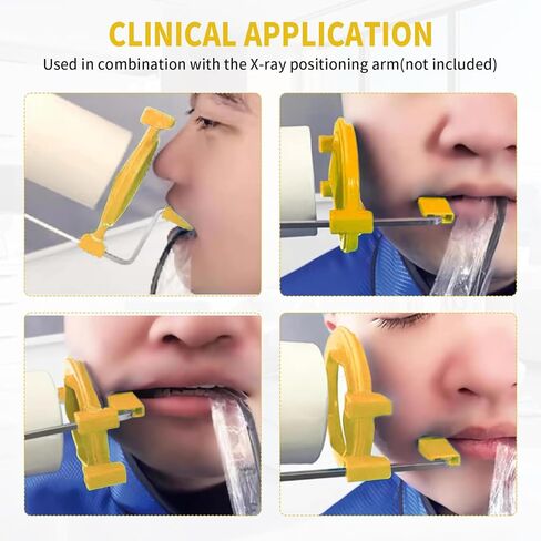PER4MANCE Dental X-Ray Aiming Rings, Each Pack of 5, Red & Yellow, Fully Autoclavable in Kuwait