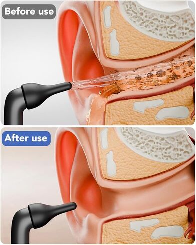 إزالة شمع الأذن الكهربائية، مجموعة تنظيف الأذن مع منظف الأذن الذي يعمل بالطاقة المائية، تتميز بـ 3 إعدادات للضغط و12 نصيحة بديلة، أداة فعالة لتنظيف الأذن in Kuwait