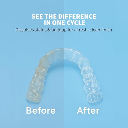 منظف ​​iSonic المحمول بالموجات فوق الصوتية + مجموعة مزيج مسحوق التنظيف الكريستالي لأطقم الأسنان والمصففات والمثبتات - نظام تنظيف عميق للبقع والروائح وإزالة التراكمات in Kuwait