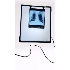 صندوق عرض LED للأشعة السينية مع زر تفعيل فيلم والتحكم في السطوع المتغير، مقاس أبيض - 14 × 17 بوصة، عبوة من قطعة واحدة in Kuwait