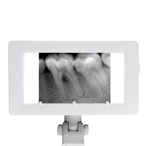 X-Ray Film Illuminator Light Box X-ray Viewer Light Panel Screen Oral Hygiene Panorama AC24V in Kuwait