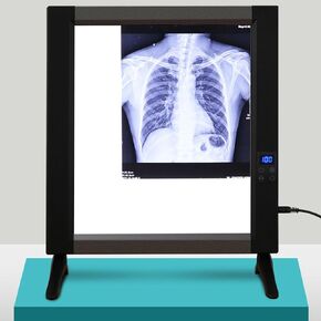 X-Ray Film Illuminator Light Box, Adjustable Brightness X-ray Viewer Light Panel Screen with Bracket Film Viewing Lamp,No Shadows in Saudi Arabia