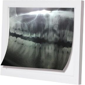 X-Ray LED Illuminator Wall Mounting View Box Film Illuminator Light Box, 6000-6500K Color Temperature, 90% Brightness Uniformity, 30.8cm*21.3cm Viewing Area, No Shadows, for Clinic Hospital. in Saudi Arabia