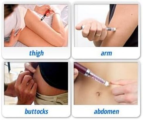 Clever Choice ComfortEZ Insulin Pen Needles 33G 4mm 100/bx in Saudi Arabia