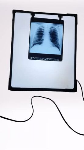 صندوق عرض LED للأشعة السينية مع زر تفعيل فيلم والتحكم في السطوع المتغير، مقاس أبيض - 14 × 17 بوصة، عبوة من قطعة واحدة in Kuwait