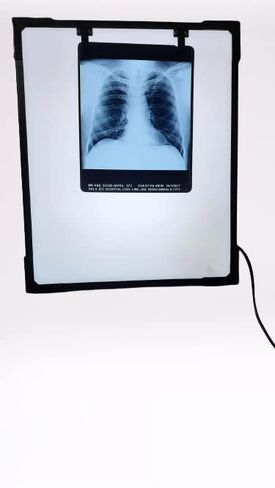 صندوق عرض LED للأشعة السينية مع زر تفعيل فيلم والتحكم في السطوع المتغير، مقاس أبيض - 14 × 17 بوصة، عبوة من قطعة واحدة in Kuwait