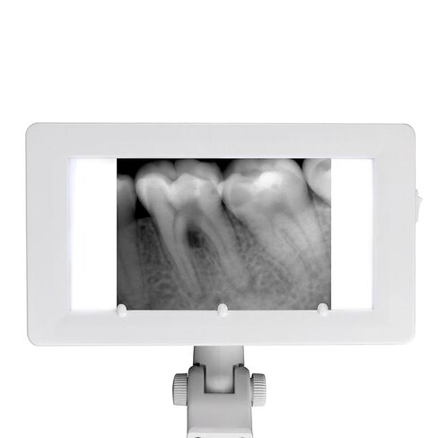 X-Ray Film Illuminator Light Box X-ray Viewer Light Panel Screen Oral Hygiene Panorama AC24V in Kuwait
