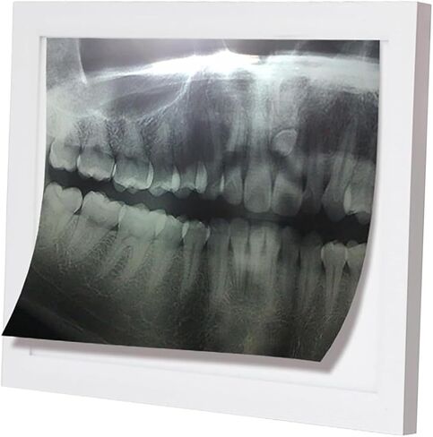 X-Ray LED Illuminator Wall Mounting View Box Film Illuminator Light Box, 6000-6500K Color Temperature, 90% Brightness Uniformity, 30.8cm*21.3cm Viewing Area, No Shadows, for Clinic Hospital. in Saudi Arabia