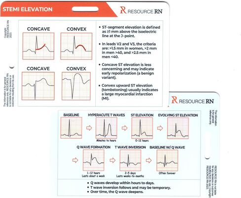 EKG Rhythm Analysis Reference Cards – 6-Card Set for Quick Interpretation – Compatible for Both Horizontal & Vertical Layout in Kuwait