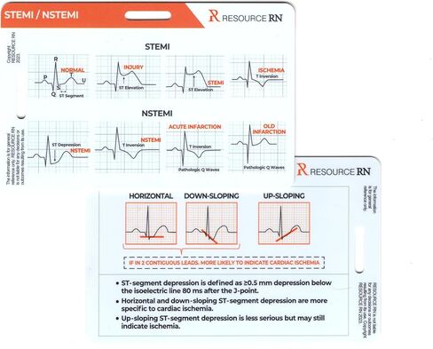 EKG Rhythm Analysis Reference Cards – 6-Card Set for Quick Interpretation – Compatible for Both Horizontal & Vertical Layout in Kuwait