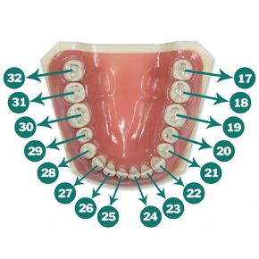Typodont 860 أسنان بديلة مع تيجان وتجاويف، 5 أسنان لكل مرجع (5 عبوات) (#1 تجويف (5 عبوات)) in Kuwait