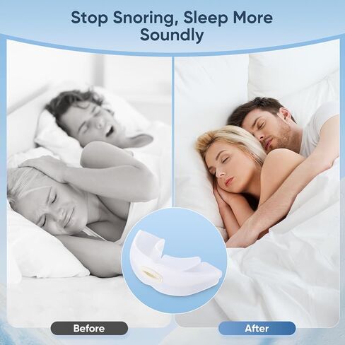 Anti-Snoring Device, Reusable Snore Stopper Anti Snoring Mouthpiece, Snoring Solution Mouthpiece Stop Snoring for Men and Women in Saudi Arabia