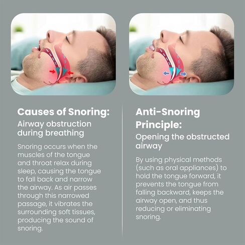 قطعة الفم لجهاز تثبيت اللسان - قابلة لإعادة الاستخدام، خالية من مادة BPA، ومحلول مضاد للشخير ومثبت مريح للسان لوقف الشخير من أجل نوم أفضل، يناسب الرجال والنساء - دوكس in Kuwait