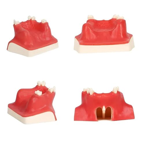 Dental Implant Training Model with Maxillary Sinus Lift Practice Realistic Simulation Jaw Cavity Lift Implant Placement Model in Kuwait