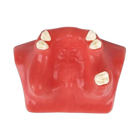 Dental Implant Training Model with Maxillary Sinus Lift Practice Realistic Simulation Jaw Cavity Lift Implant Placement Model in Kuwait