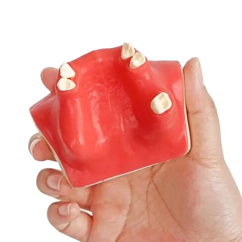 Dental Implant Training Model with Maxillary Sinus Lift Practice Realistic Simulation Jaw Cavity Lift Implant Placement Model in Kuwait