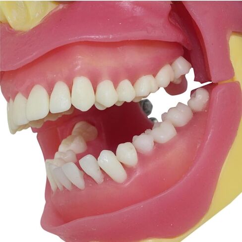 Oral Surgery Teaching Practice Tooth Extraction Model Anesthesia in Saudi Arabia