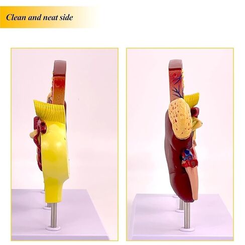 Kidney Nephron Glomerulus Anatomy Model, Which Can Show The Structure and Function of Human, with Accurate Anatomical in Saudi Arabia
