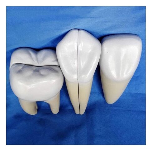 Dental implant Tooth Anatomy Model Learning Teaching Standard Model Human Anatomy Model in Saudi Arabia