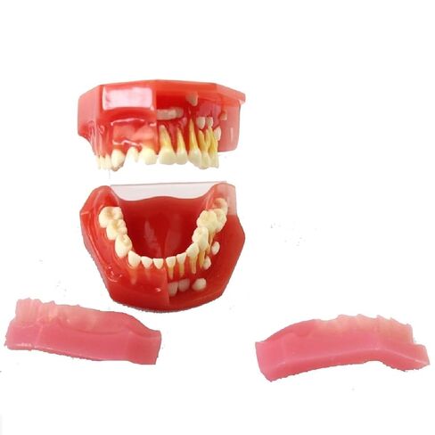 S Tooth Model 's Deciduous Development Dentition Used for Oral Teaching Demonstration in Saudi Arabia