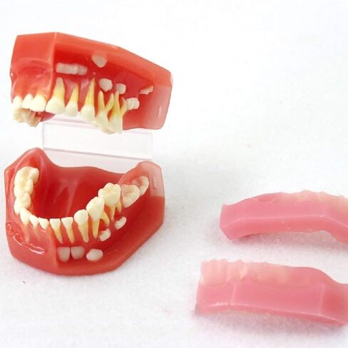 S Tooth Model 's Deciduous Development Dentition Used for Oral Teaching Demonstration in Saudi Arabia