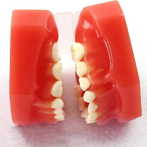 S Tooth Model 's Deciduous Development Dentition Used for Oral Teaching Demonstration in Saudi Arabia