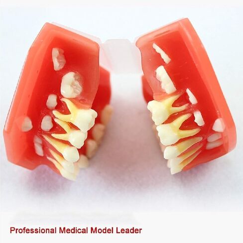 S Tooth Model 's Deciduous Development Dentition Used for Oral Teaching Demonstration in Saudi Arabia
