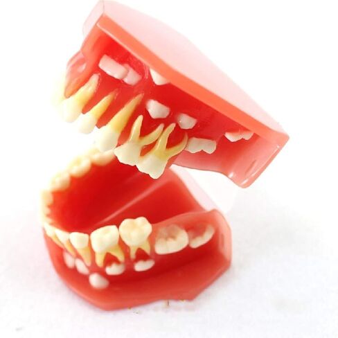 S Tooth Model 's Deciduous Development Dentition Used for Oral Teaching Demonstration in Saudi Arabia