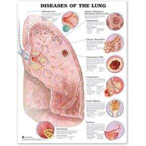 أمراض ACC في الرسم البياني التشريحي للرئة in Kuwait