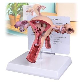 Female Reproductive Organ Model, Pathological Uterus and Ovary, Used As A Demonstration Tool for School Teaching in Kuwait