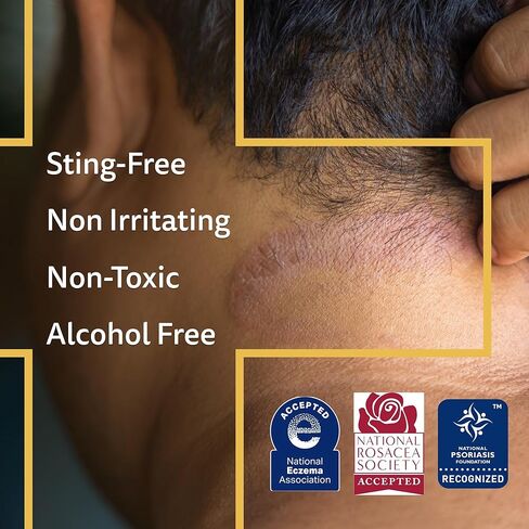 A+D Advanced Dermatitis Care Hydrogel Spray with Hypochlorous Acid 4 oz.– Cooling Antimicrobial Spray for Eczema, Psoriasis & Rosacea-Prone Skin, Reduces Itch, Redness & Inflammation in Kuwait