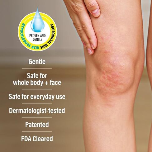 A+D Advanced Dermatitis Care Hydrogel Spray with Hypochlorous Acid 4 oz.– Cooling Antimicrobial Spray for Eczema, Psoriasis & Rosacea-Prone Skin, Reduces Itch, Redness & Inflammation in Kuwait