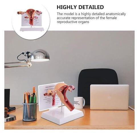 Female Reproductive Organ Model, Pathological Uterus and Ovary, Used As A Demonstration Tool for School Teaching in Kuwait