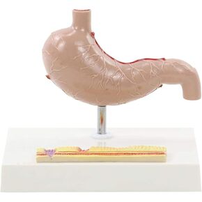 Stomach Anatomical Model Human Organ Pathology Teaching Aids in Kuwait