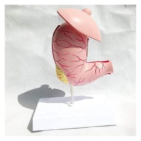 Stomach Disease Anatomical Model, Human, Digestive System Medical in Kuwait